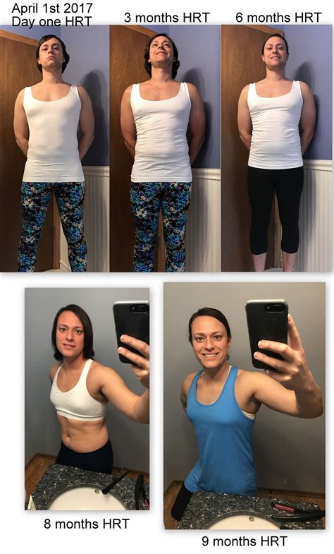 <strong>Before After</strong> - M2F - 2 year 9 months <strong>HRT</strong>. . Hrt breast growth before and after